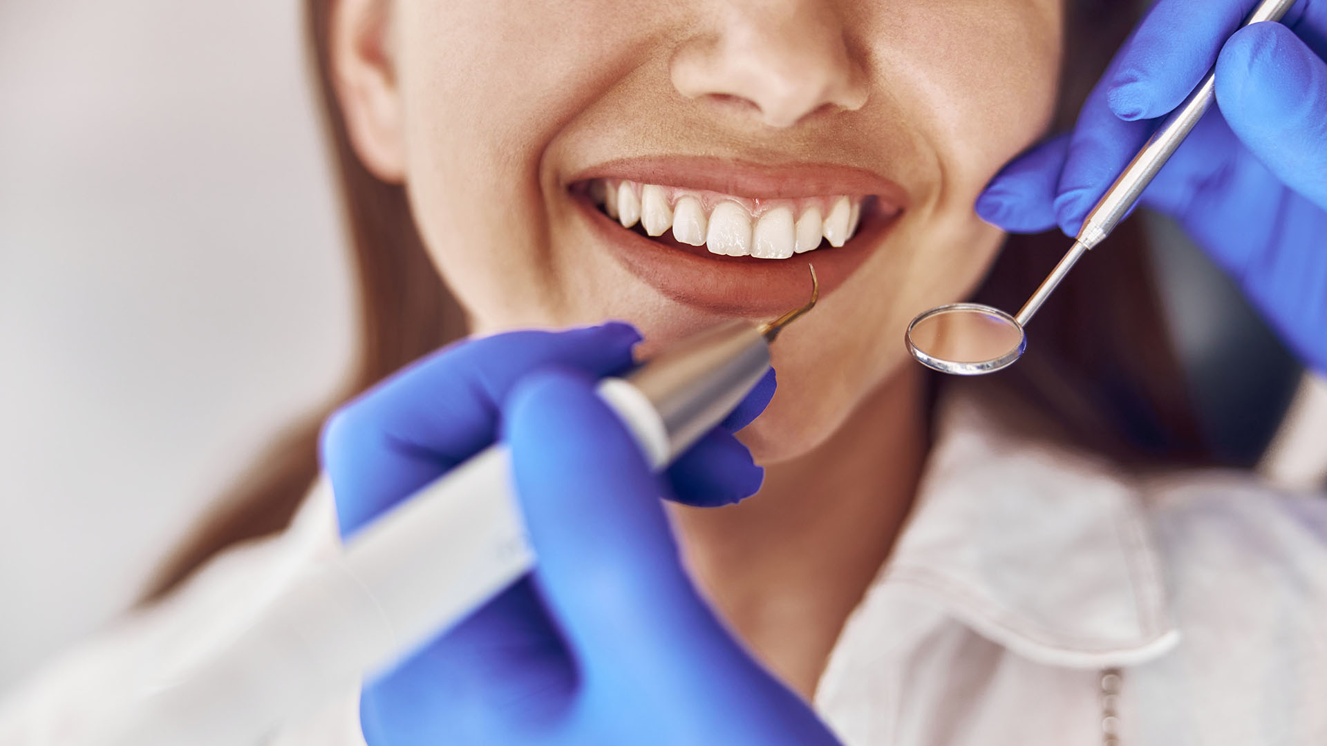 Esztétikai fogászat: mit jelent és miben segíthet?